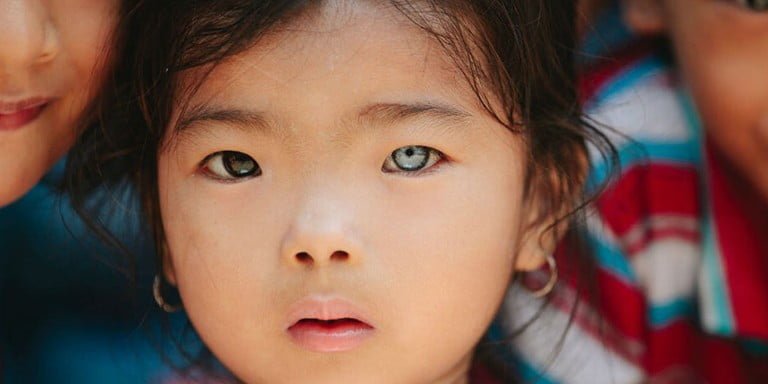 Çift Renkli Gözlerin Kaynağı Heterokromiye Dair Tüm Detaylar
